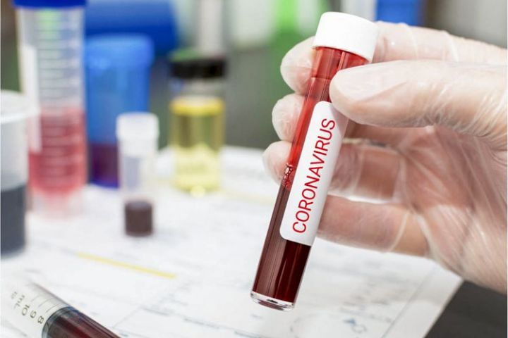 Azəraycanda koronavirusa yeni yoluxma faktı azalır