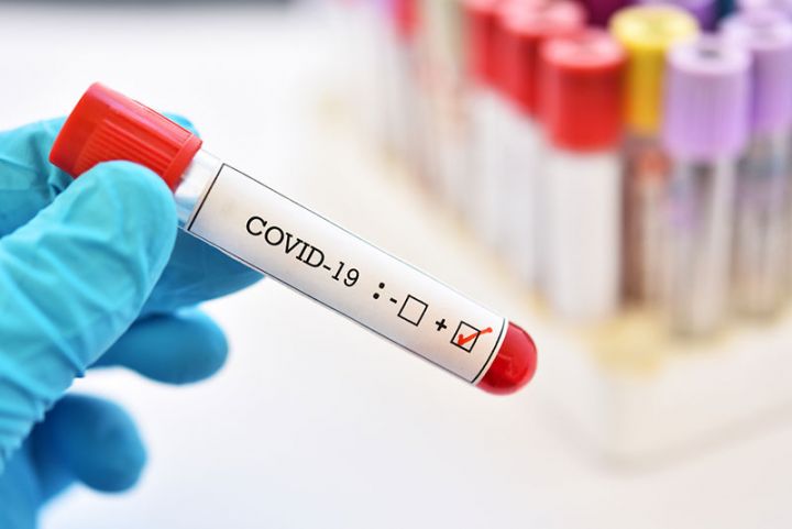"Referans Klinik"-də COVID-19 testinə 5% endirim