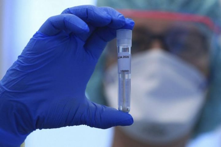 İranda koronavirusdan  221 nəfər də vəfat edib