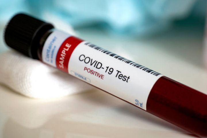 ABŞ-da koronavirusa rekord sayda yoluxma qeydə alınıb