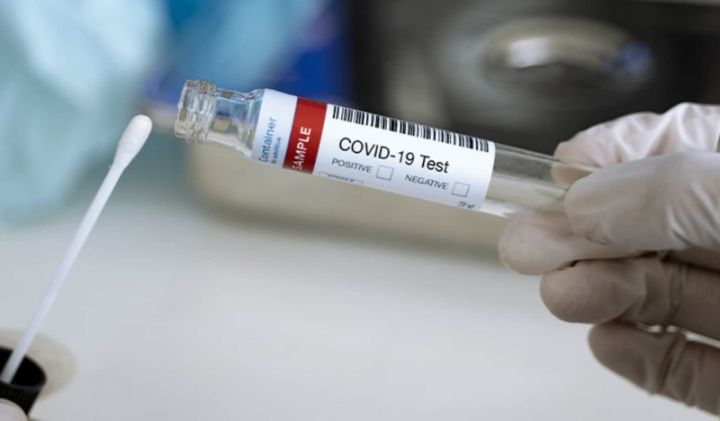 Azərbaycan koronavirus ilə bağlı son vəziyyət açıqlandı