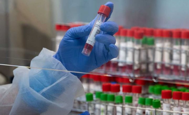 Azərbaycanda koronavirus ilə bağlı son vəziyyət açıqlandı