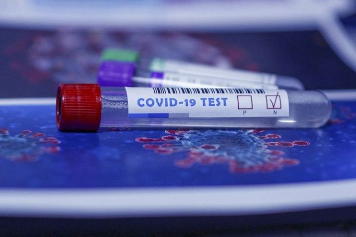 TƏBİB Azərbaycanda koronavirus testlərinin bitməsi barədə məlumatlara aydınlıq gətirdi