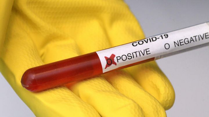 Azərbaycanda daha böyük sayda koronavirusa yoluxma olduğu açıqlandı