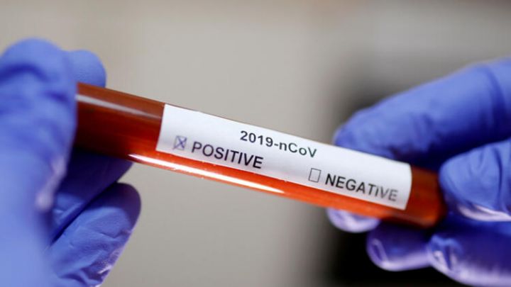 Klinikaların koronavirus testi müayinələrini dayandırdıqları bildirilir