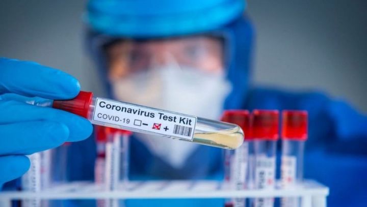 Azərbaycanda koronavirusa yoluxanlar daha da artdı